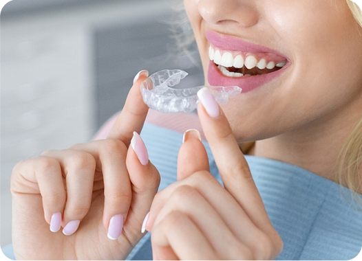 Invisalign Process