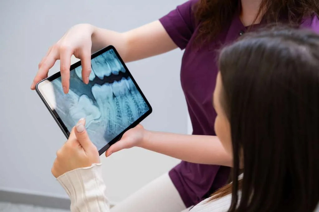 Wisdom Tooth Extraction