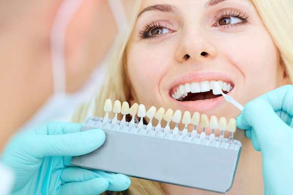 True Dental Veneer Experience